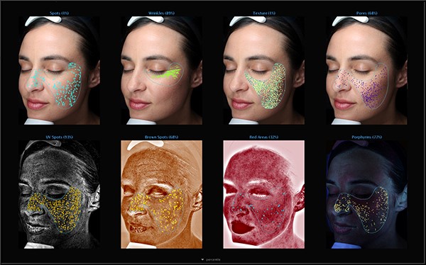 Hautanalyse per VISIA Gen 7 bei Beauty Concept